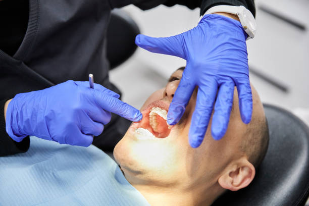 Best Emergency Dentist for Knocked-Out Tooth in Bay City, OR